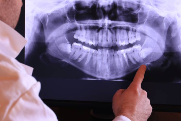 Best Urgent Dental Care for Toothaches in New Canaan, CT